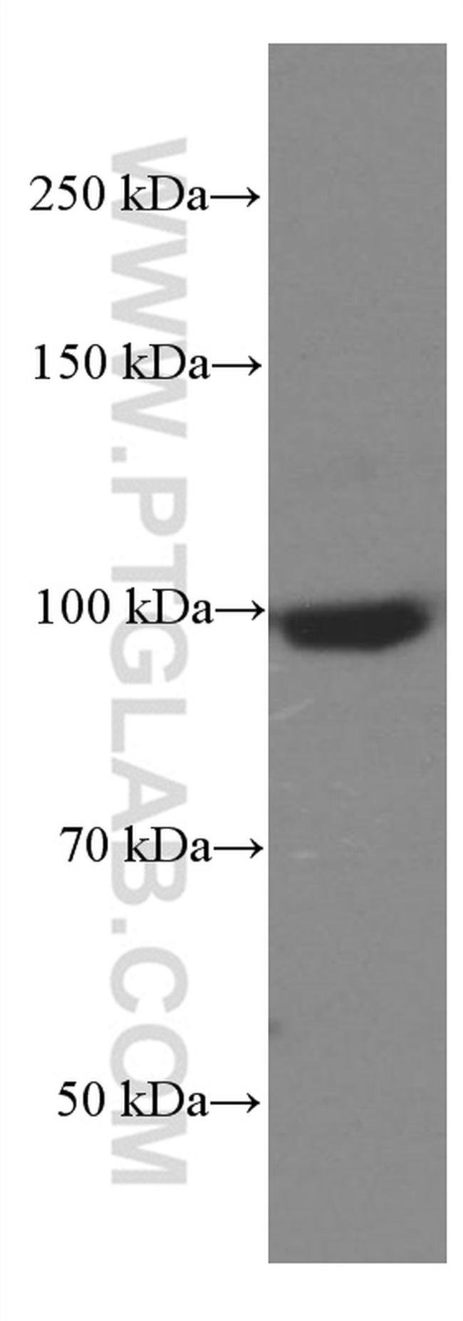 SEC5/EXOC2 Antibody in Western Blot (WB)