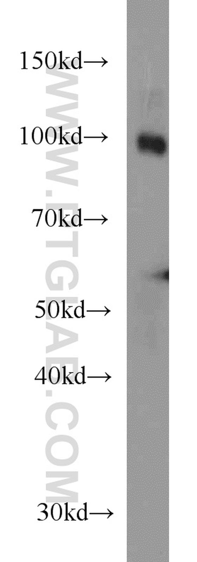 SEC5/EXOC2 Antibody in Western Blot (WB)