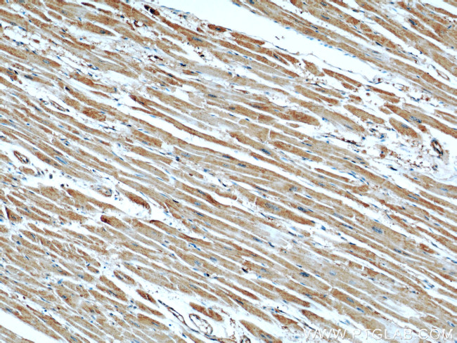 GEFT Antibody in Immunohistochemistry (Paraffin) (IHC (P))