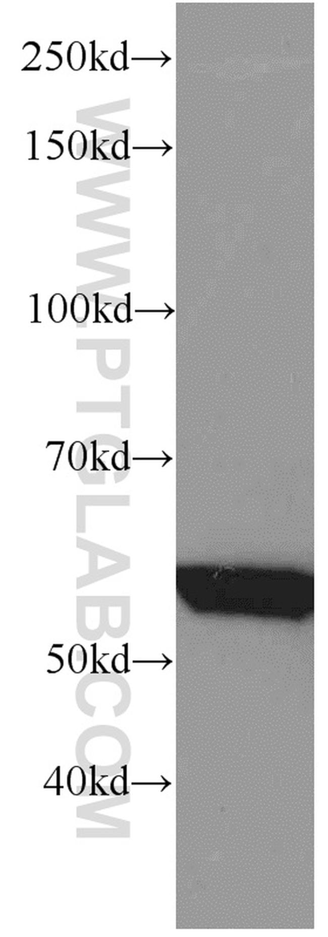 GEFT Antibody in Western Blot (WB)