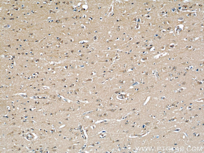 GEFT Antibody in Immunohistochemistry (Paraffin) (IHC (P))