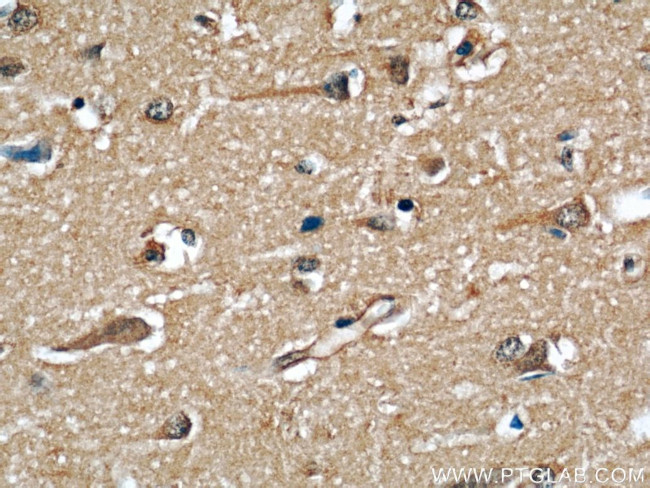 GEFT Antibody in Immunohistochemistry (Paraffin) (IHC (P))