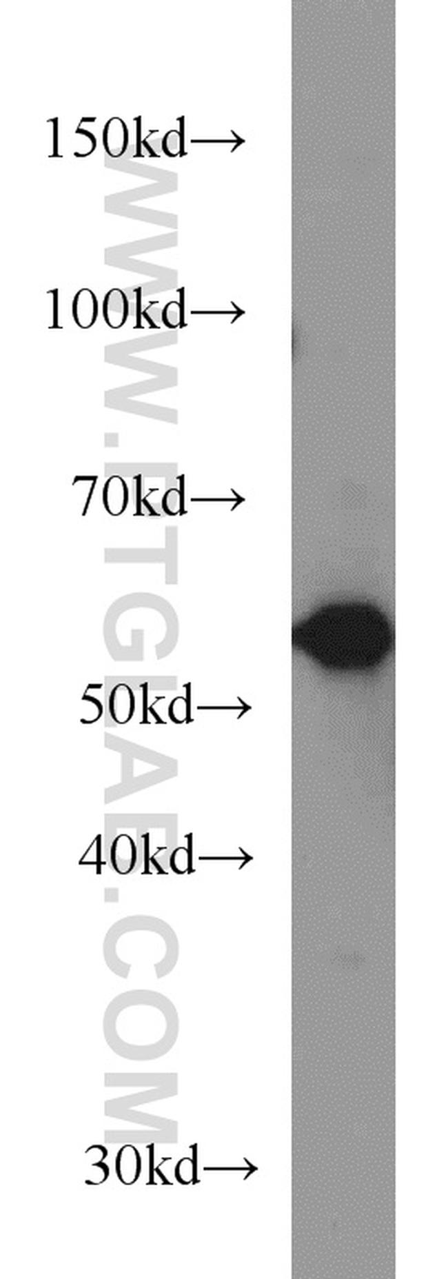 GEFT Antibody in Western Blot (WB)