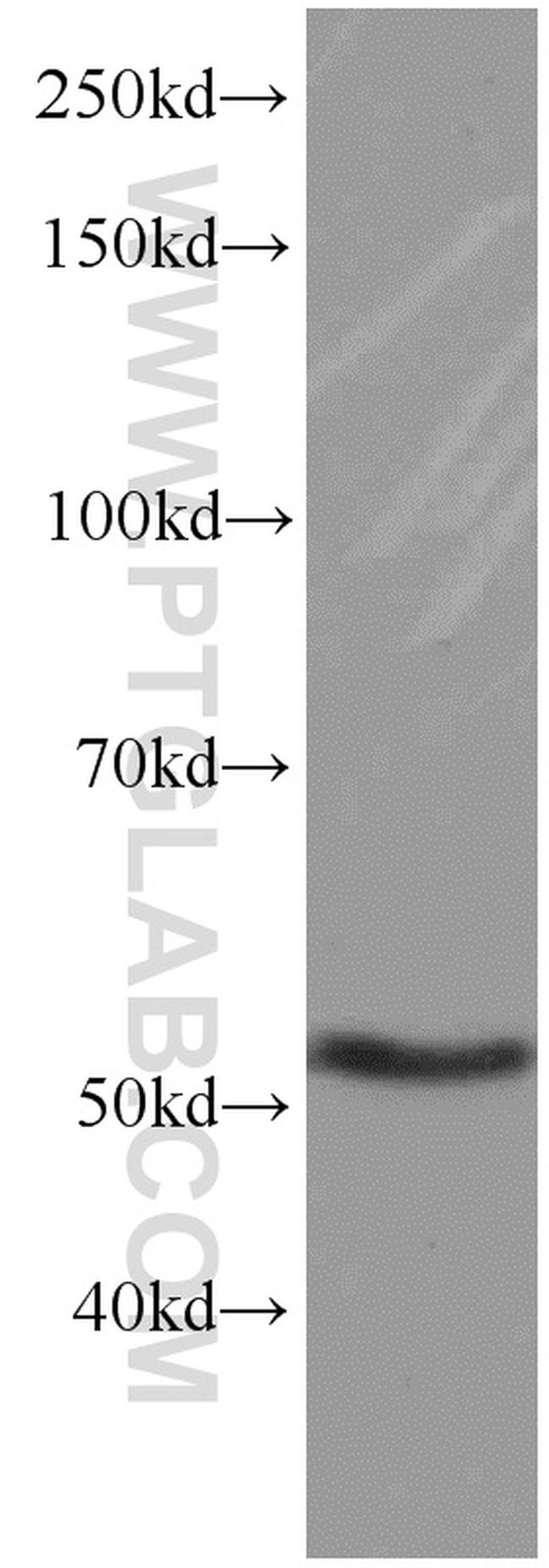 GEFT Antibody in Western Blot (WB)