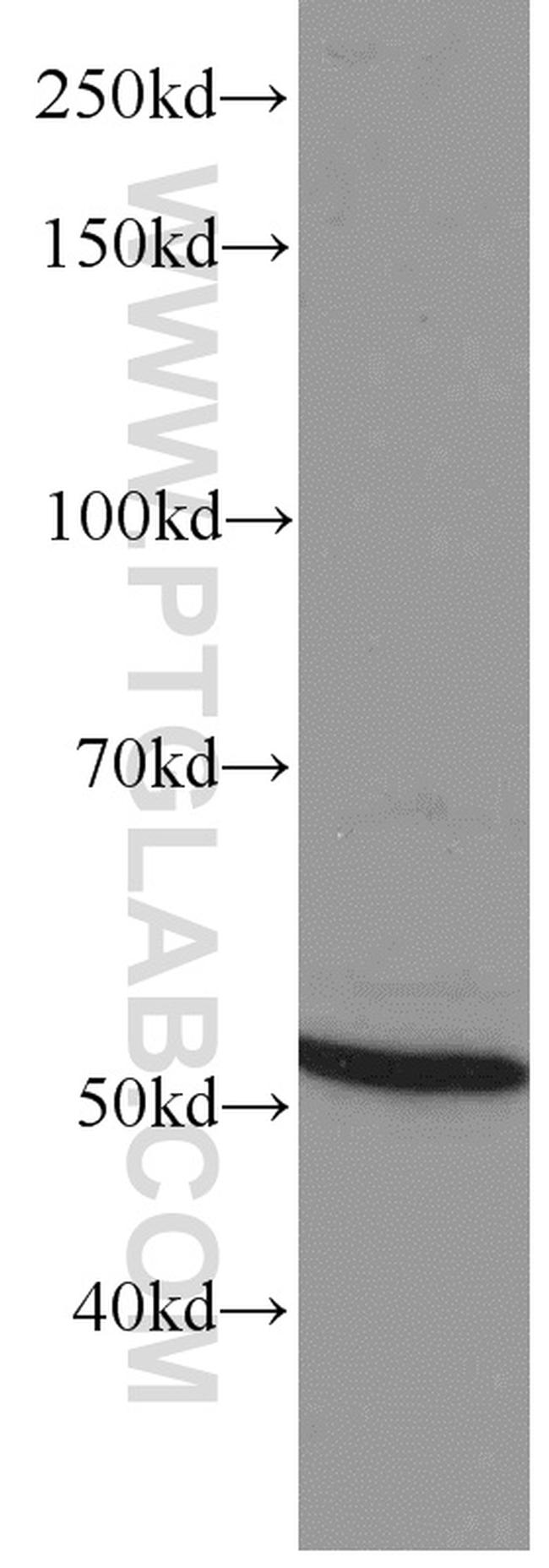 GEFT Antibody in Western Blot (WB)