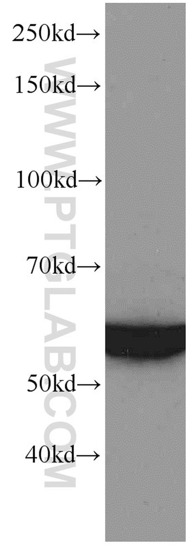 GEFT Antibody in Western Blot (WB)