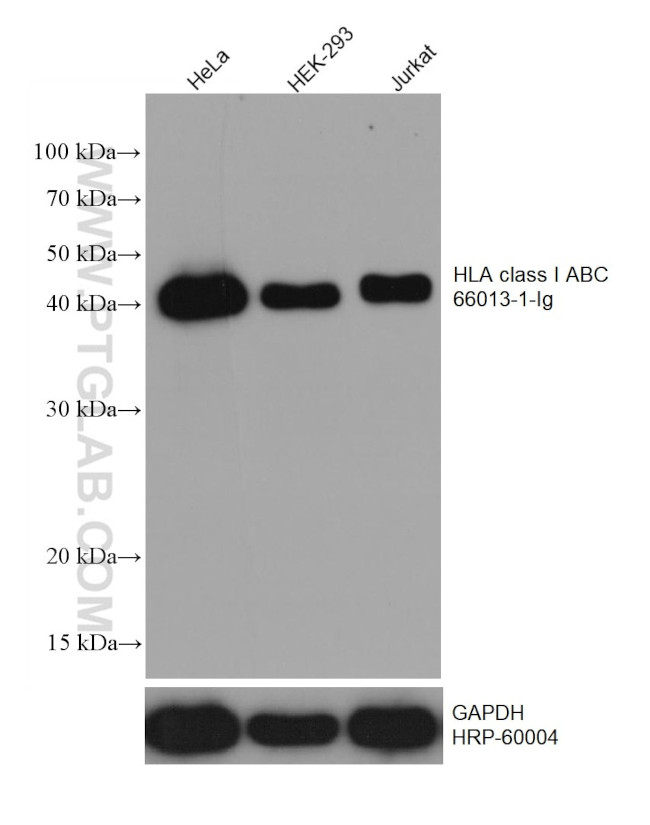 HLA class I ABC Antibody in Western Blot (WB)