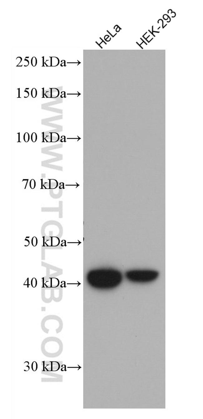 HLA class I ABC Antibody in Western Blot (WB)