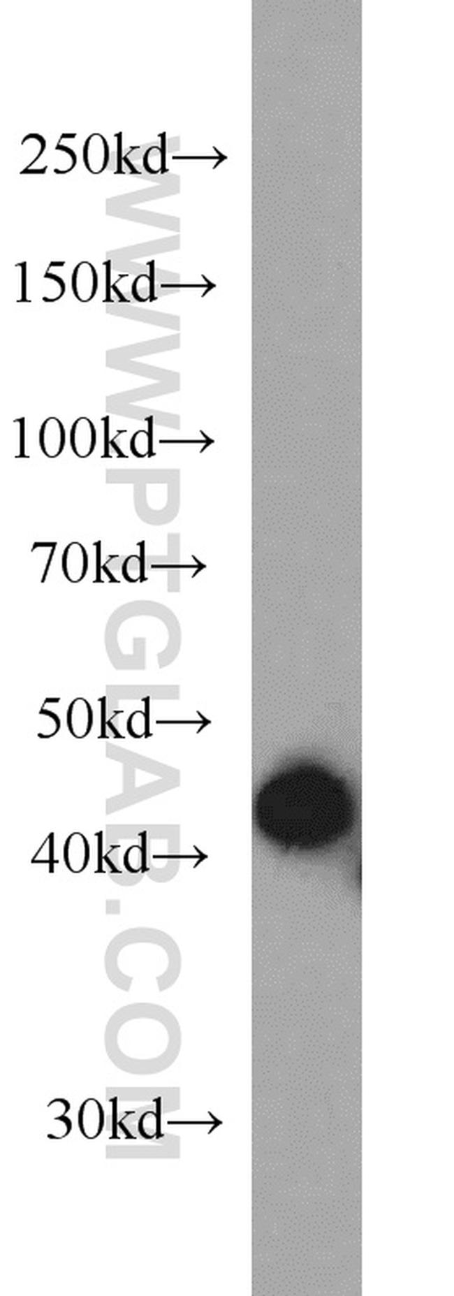 HLA class I ABC Antibody in Western Blot (WB)