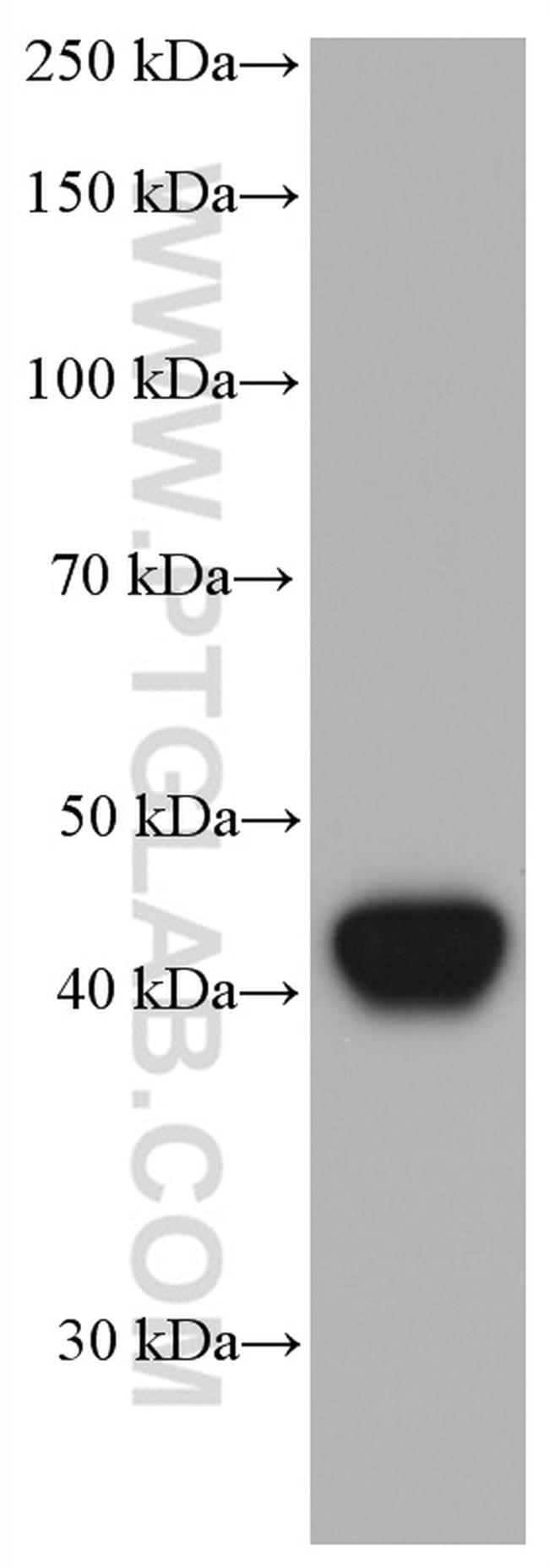 HLA class I ABC Antibody in Western Blot (WB)