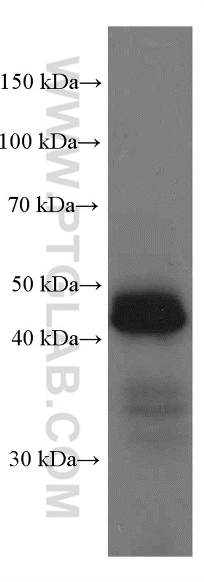 HLA class I ABC Antibody in Western Blot (WB)