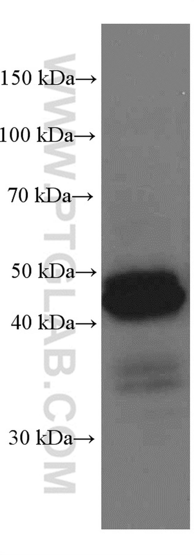 HLA class I ABC Antibody in Western Blot (WB)