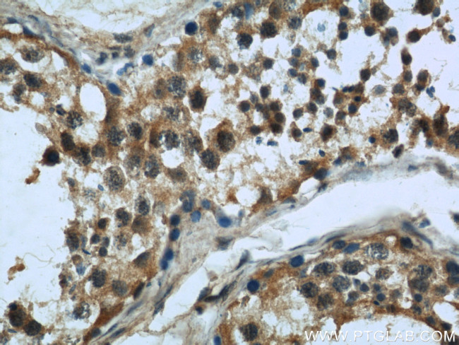 MAD2L1 Antibody in Immunohistochemistry (Paraffin) (IHC (P))