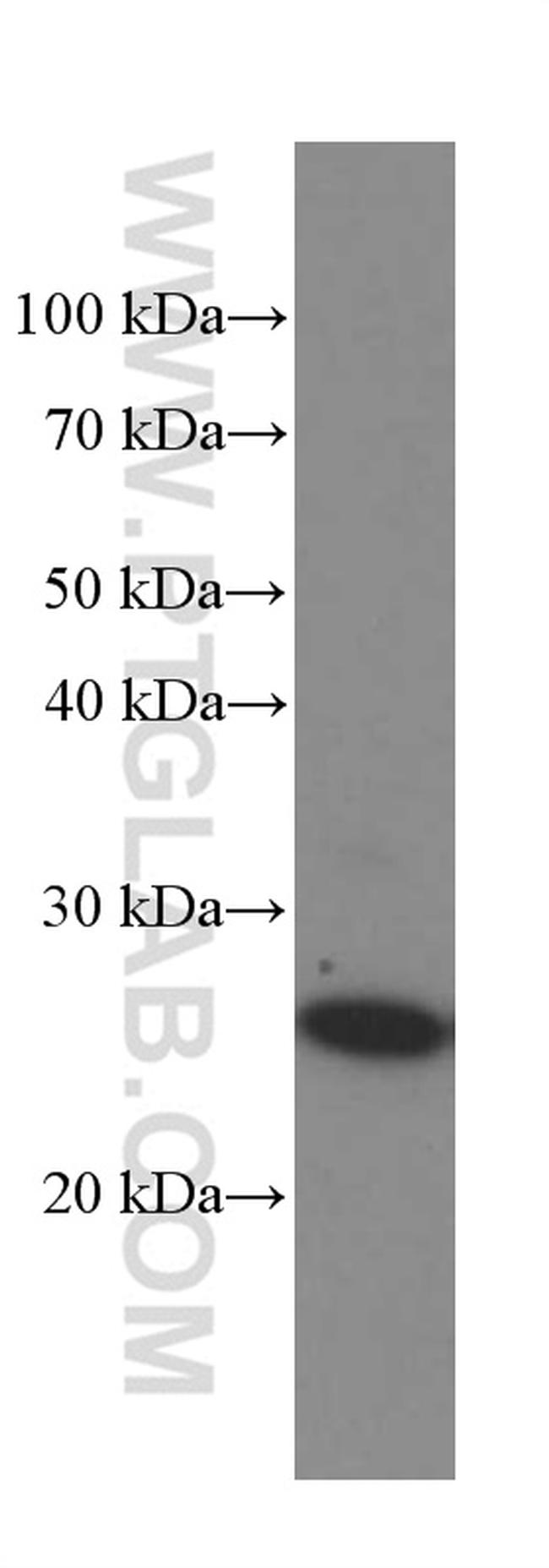 MAD2L1 Antibody in Western Blot (WB)