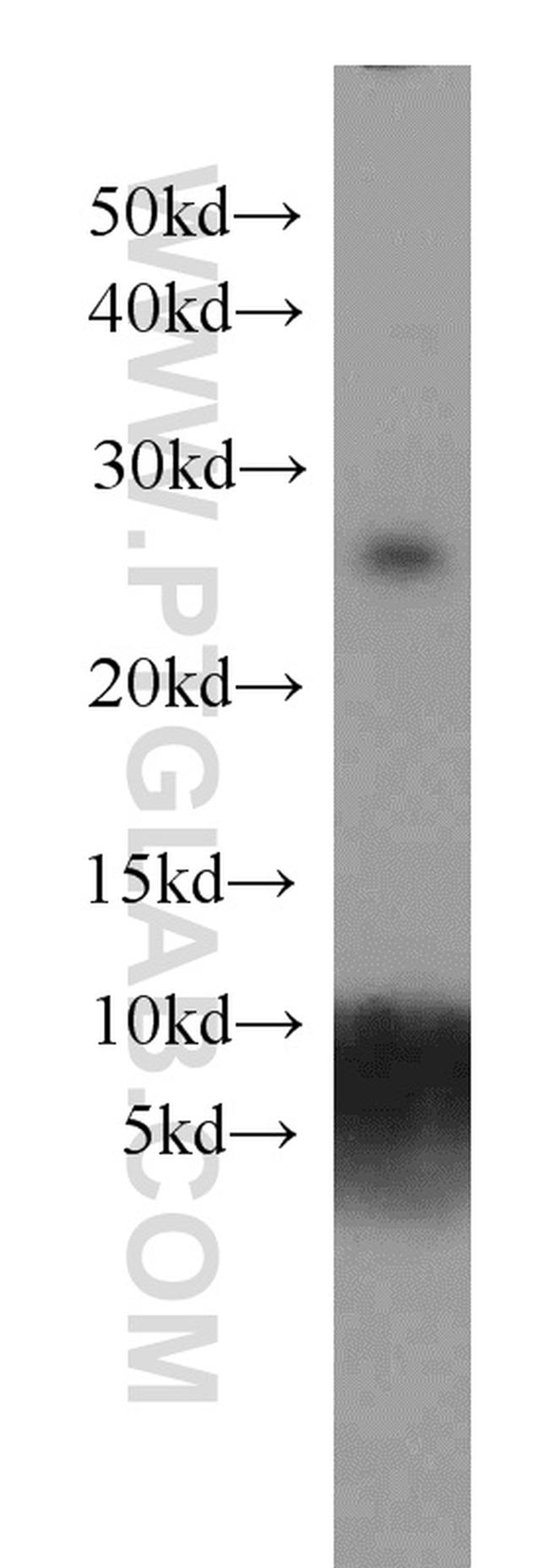 MAD2L1 Antibody in Western Blot (WB)