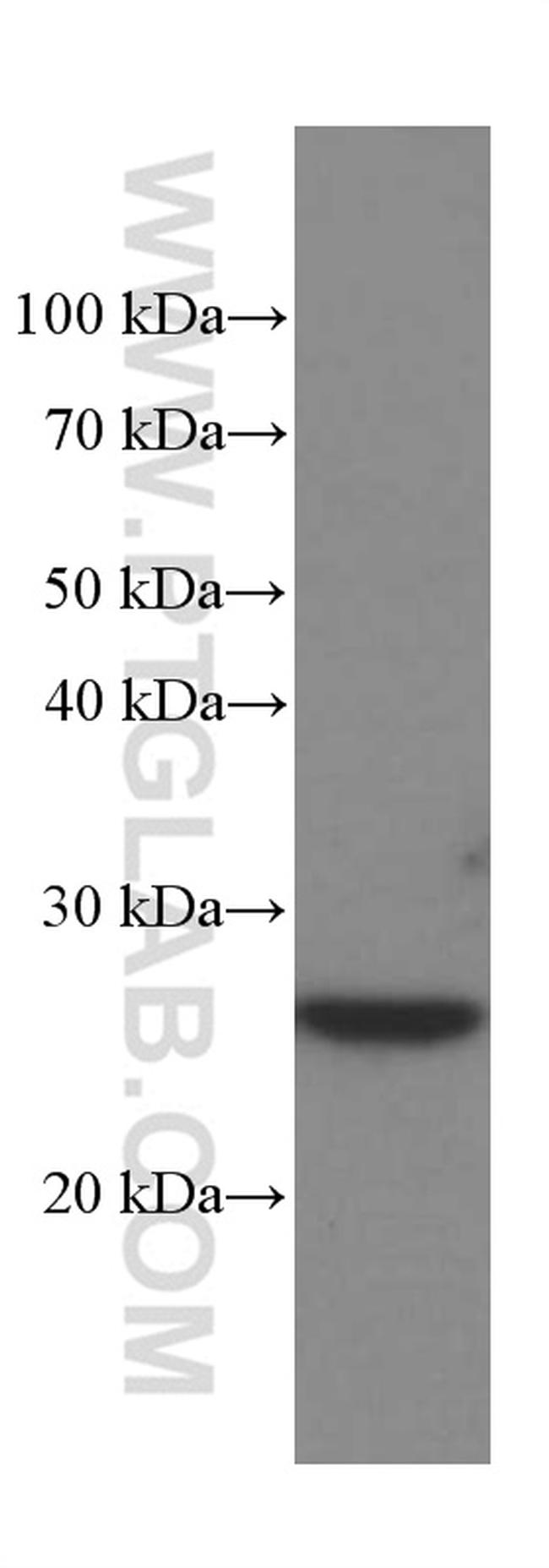 MAD2L1 Antibody in Western Blot (WB)