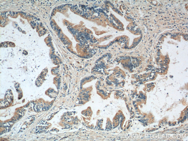 RBBP9 Antibody in Immunohistochemistry (Paraffin) (IHC (P))