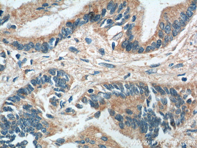 RBBP9 Antibody in Immunohistochemistry (Paraffin) (IHC (P))