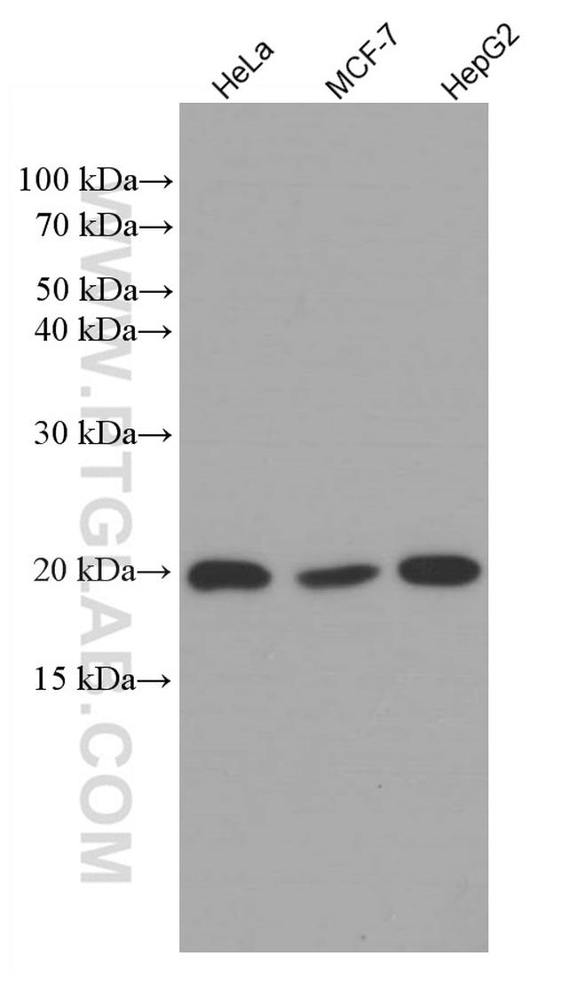 RBBP9 Antibody in Western Blot (WB)