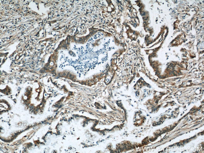 RBBP9 Antibody in Immunohistochemistry (Paraffin) (IHC (P))