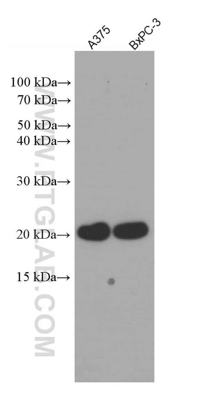 RBBP9 Antibody in Western Blot (WB)