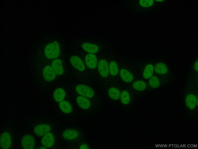 Transketolase Antibody in Immunocytochemistry (ICC/IF)