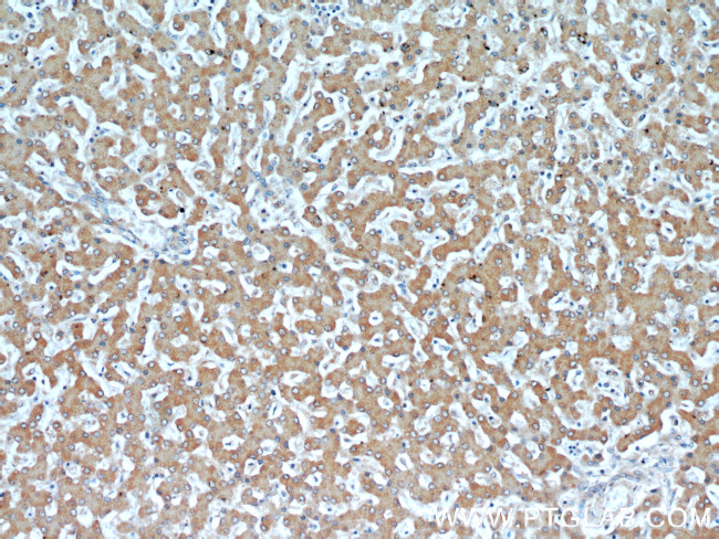 Transketolase Antibody in Immunohistochemistry (Paraffin) (IHC (P))