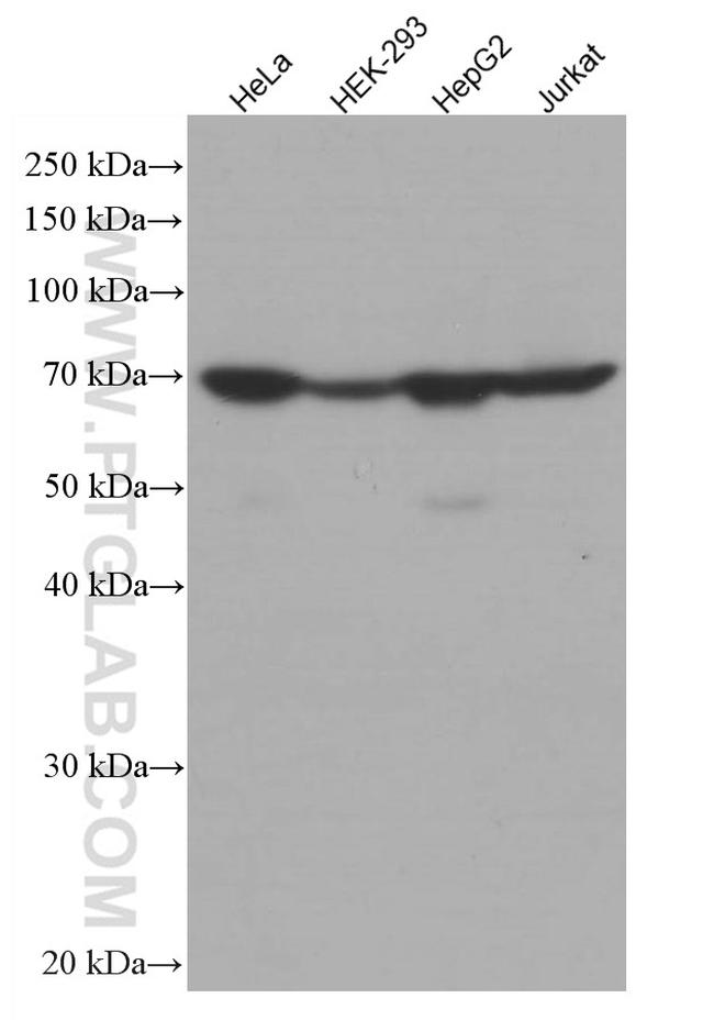 Transketolase Antibody in Western Blot (WB)