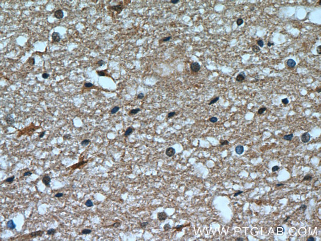 Transketolase Antibody in Immunohistochemistry (Paraffin) (IHC (P))