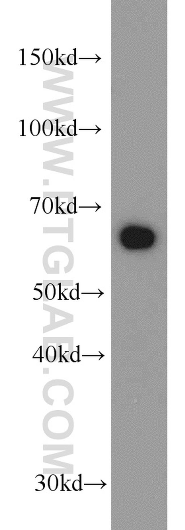 Transketolase Antibody in Western Blot (WB)