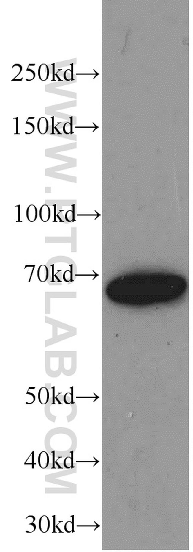 Transketolase Antibody in Western Blot (WB)