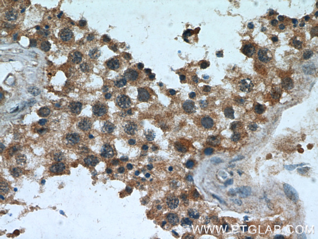 TPPII Antibody in Immunohistochemistry (Paraffin) (IHC (P))