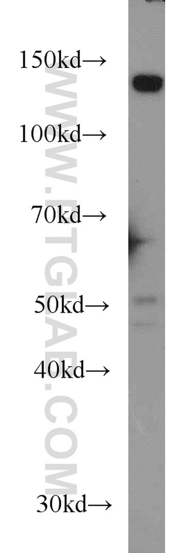 TPPII Antibody in Western Blot (WB)