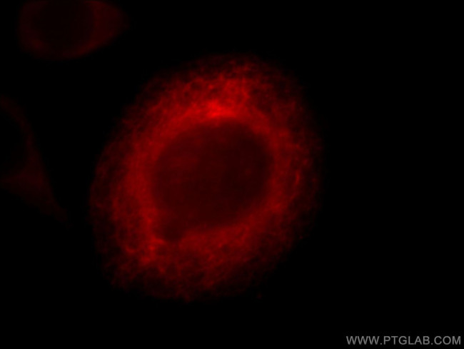 TPPII Antibody in Immunocytochemistry (ICC/IF)