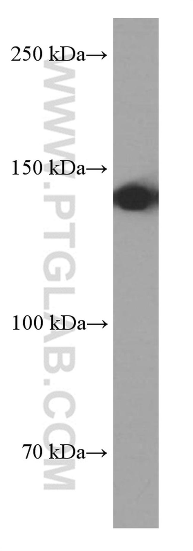 TPPII Antibody in Western Blot (WB)