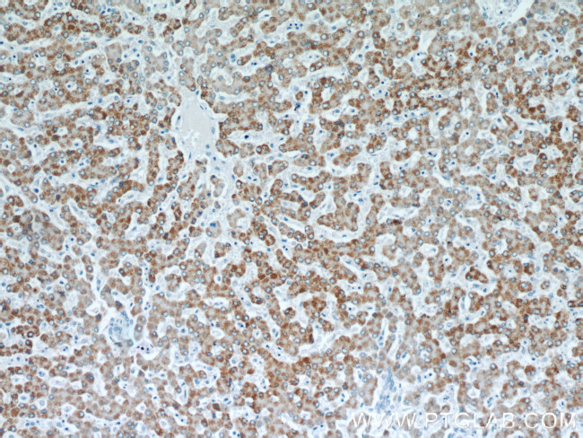 TST Antibody in Immunohistochemistry (Paraffin) (IHC (P))