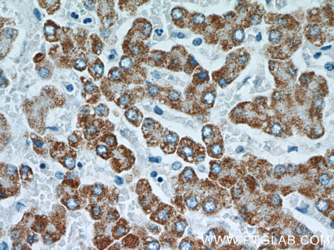 TST Antibody in Immunohistochemistry (Paraffin) (IHC (P))