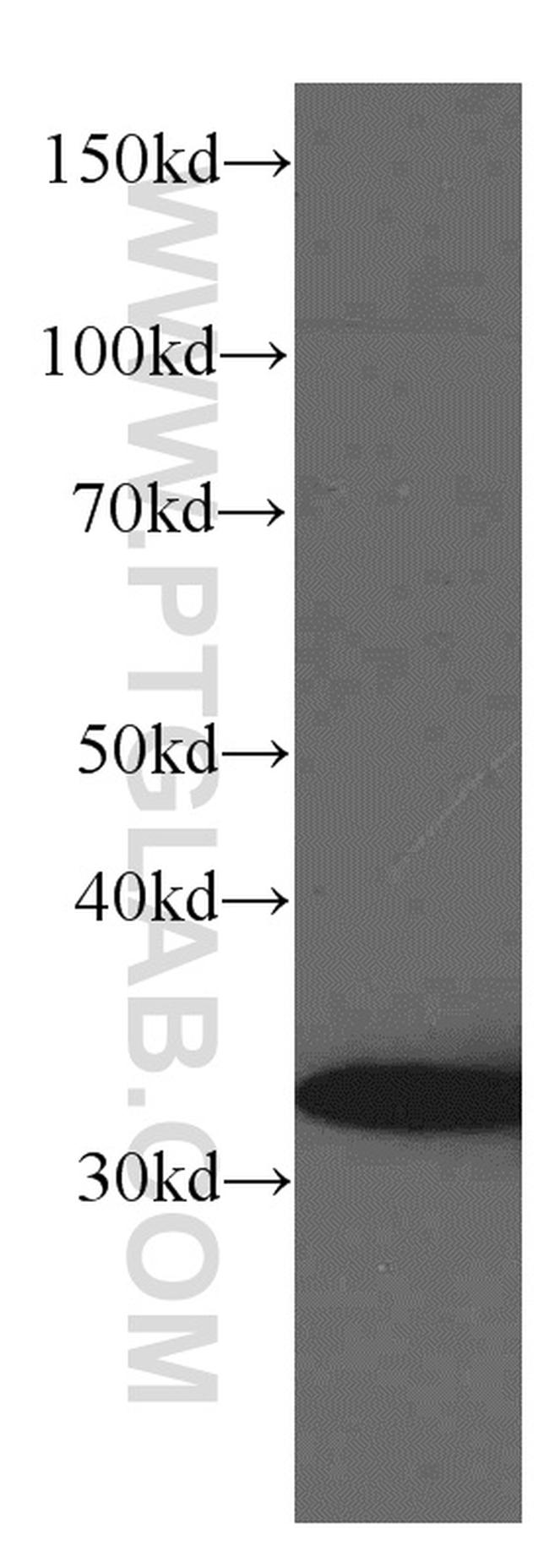 TST Antibody in Western Blot (WB)