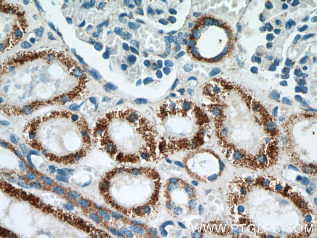 TST Antibody in Immunohistochemistry (Paraffin) (IHC (P))