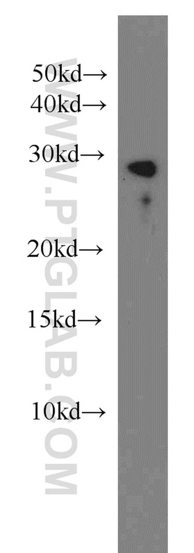 TST Antibody in Western Blot (WB)