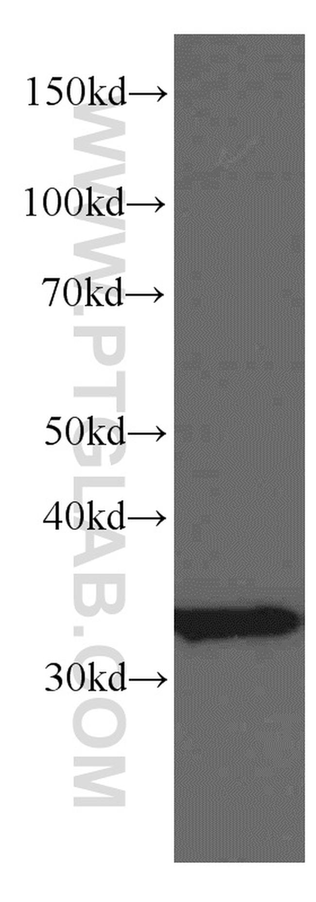 TST Antibody in Western Blot (WB)