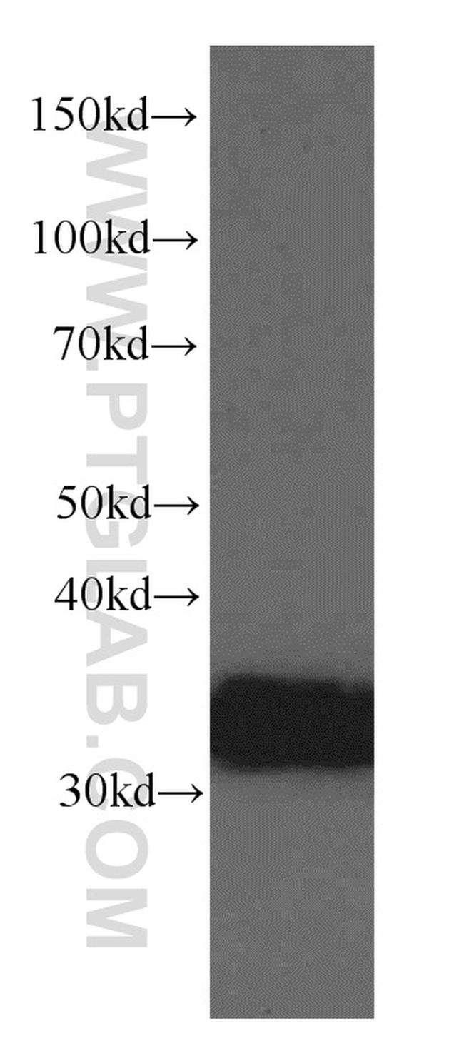 TST Antibody in Western Blot (WB)