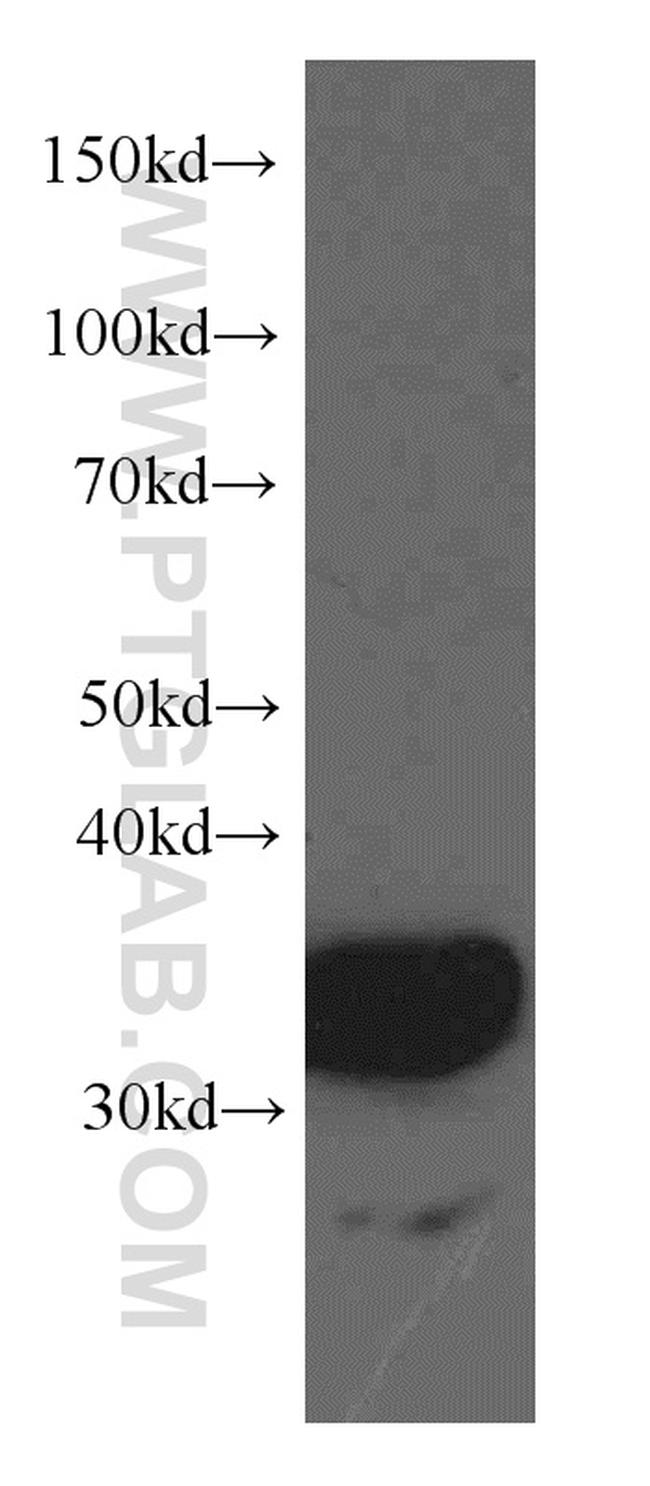 TST Antibody in Western Blot (WB)