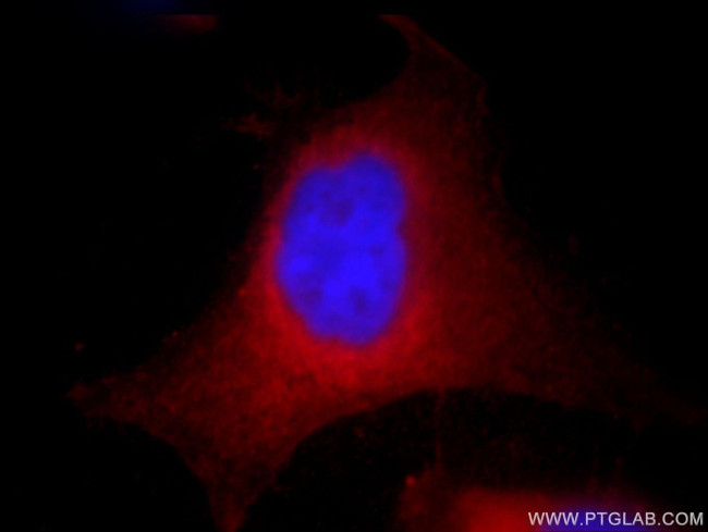 AHCY Antibody in Immunocytochemistry (ICC/IF)