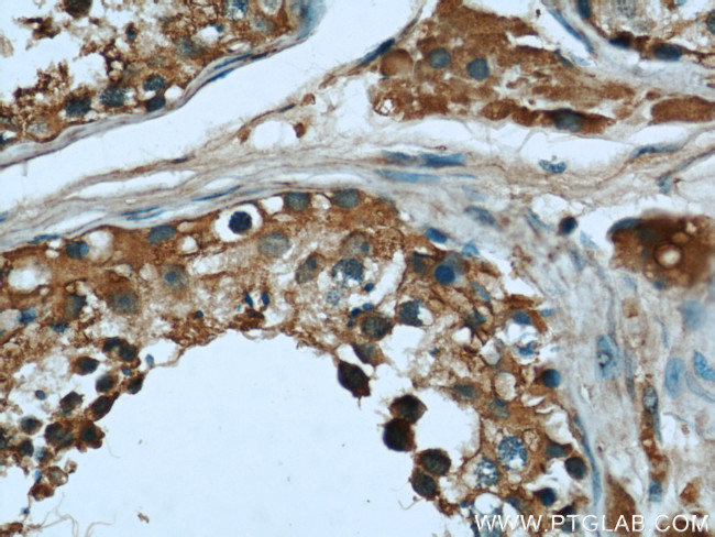 AHCY Antibody in Immunohistochemistry (Paraffin) (IHC (P))