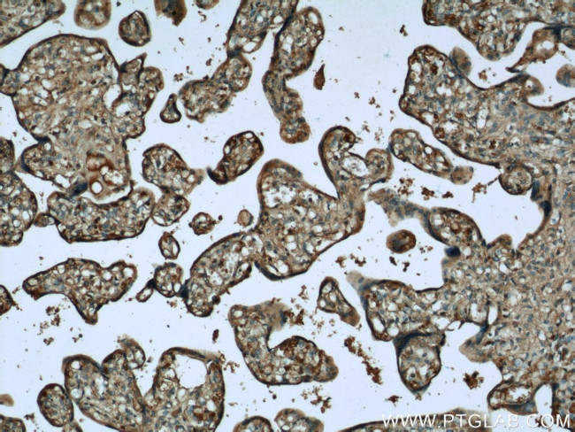 AHCY Antibody in Immunohistochemistry (Paraffin) (IHC (P))