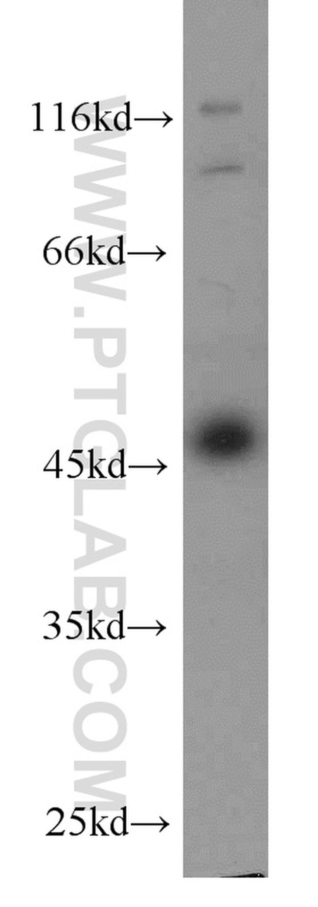 AHCY Antibody in Western Blot (WB)