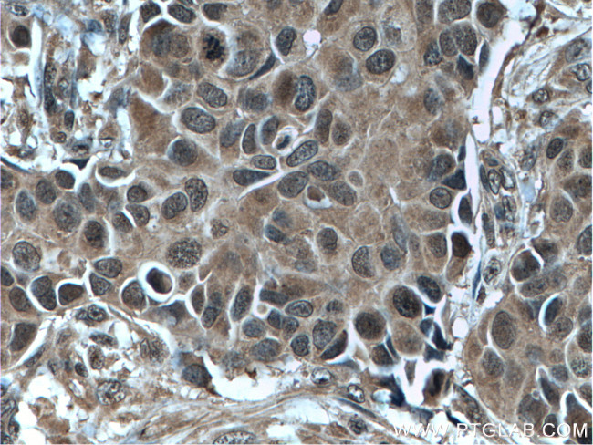 Bcl-XL Antibody in Immunohistochemistry (Paraffin) (IHC (P))