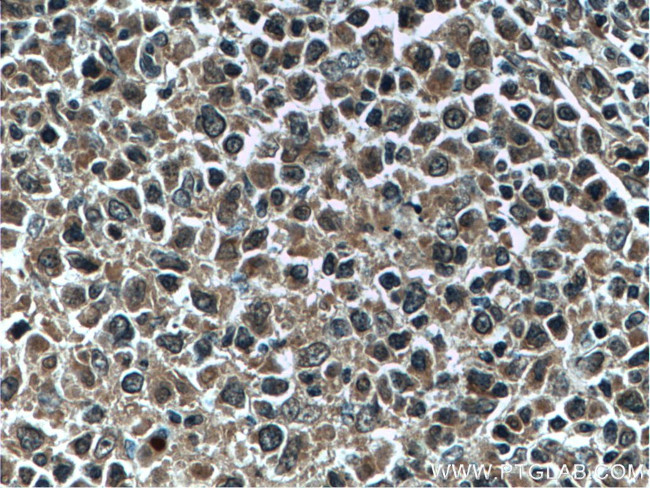 Bcl-XL Antibody in Immunohistochemistry (Paraffin) (IHC (P))