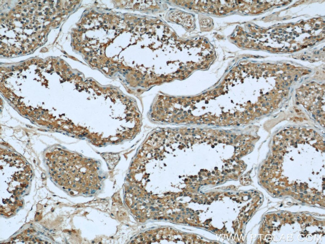 Bcl-XL Antibody in Immunohistochemistry (Paraffin) (IHC (P))